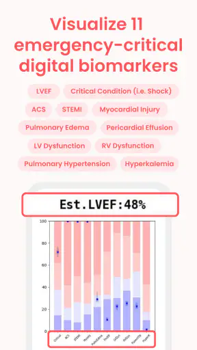 ECG Buddy | ECG Analysis AI screenshot