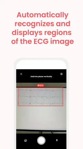 ECG Buddy | ECG Analysis AI screenshot
