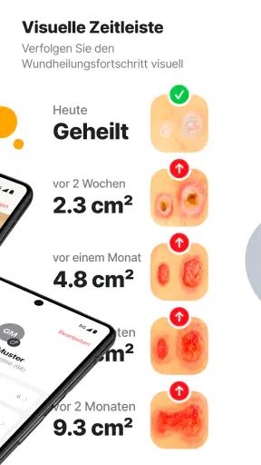imitoWound - Wunddokumentation screenshot