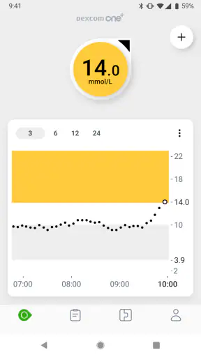 Dexcom ONE+ screenshot