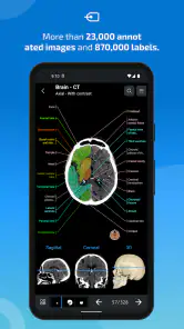 IMAIOS e-Anatomy screenshot