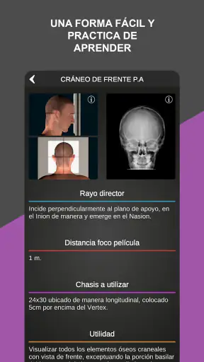 RX - Posiciones Radiológicas screenshot