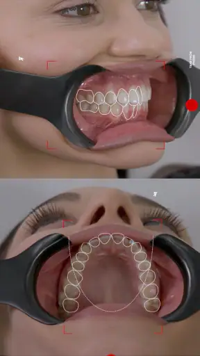 Dental Shooting screenshot