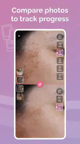 Skincare Routine: FeelinMySkin screenshot