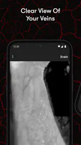 X-Vein screenshot