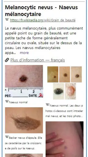 Model Derm – Maladie de peau screenshot
