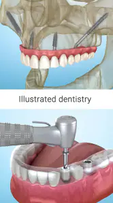 Dental 3D Illustrations screenshot