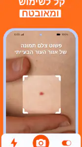 Skinive AI: סורק עור דרמטולוגי screenshot