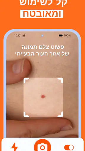 Skinive AI: סורק עור דרמטולוגי screenshot