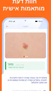 Skinive AI: סורק עור דרמטולוגי screenshot