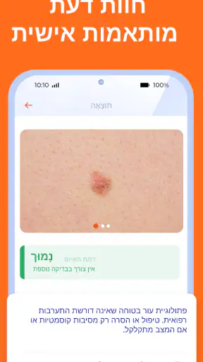 Skinive AI: סורק עור דרמטולוגי screenshot