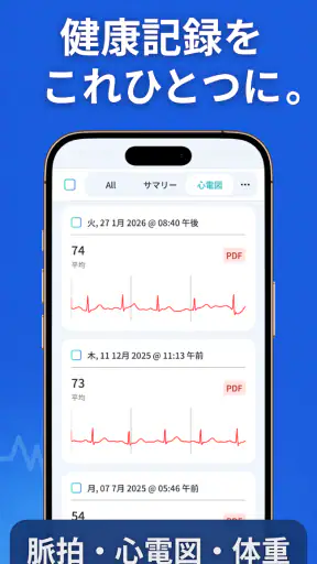 SmartBP - 血圧測定値を記録｜シンプルな高血圧管理 screenshot