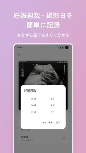 エコー写真　スキャンして簡単整理！ screenshot
