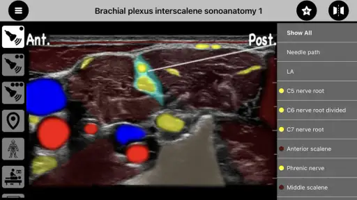 AnSo Anaesthesia Sonoanatomy screenshot