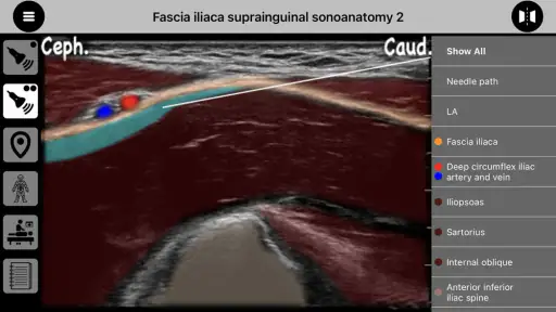 AnSo Anaesthesia Sonoanatomy screenshot