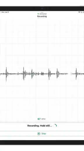 Eko: Digital Stethoscopes screenshot