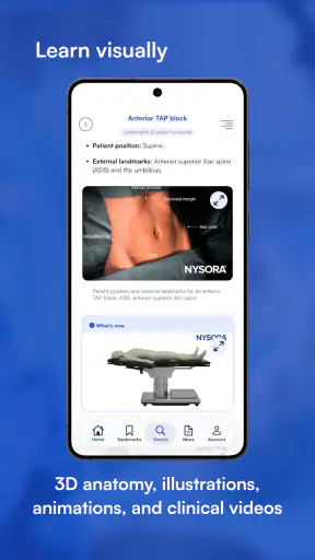 NYSORA Nerve Blocks screenshot