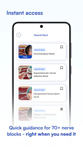 NYSORA Nerve Blocks screenshot