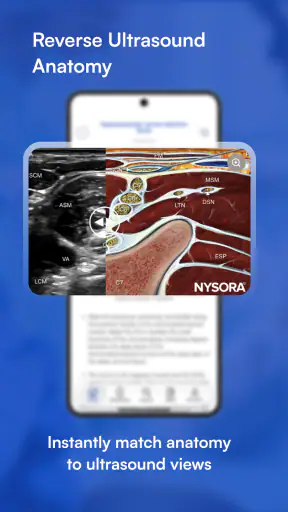 NYSORA Nerve Blocks screenshot