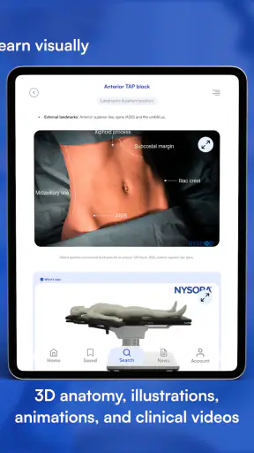 NYSORA Nerve Blocks screenshot