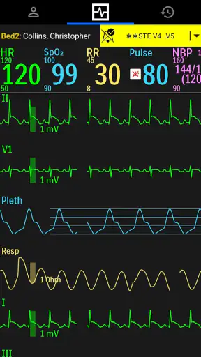 Philips Care Assist screenshot