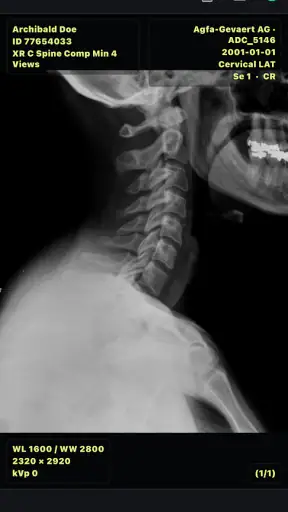 DICOM Viewer screenshot