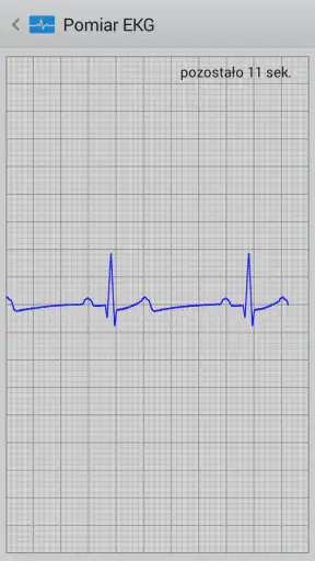 Istel ECG screenshot