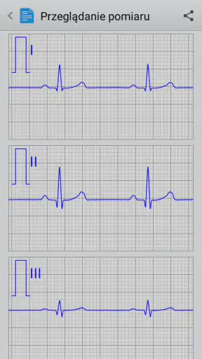 Istel ECG screenshot