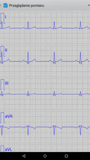 Istel ECG screenshot