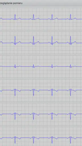Istel ECG screenshot
