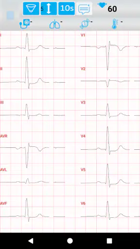 Norav Mobile ECG screenshot